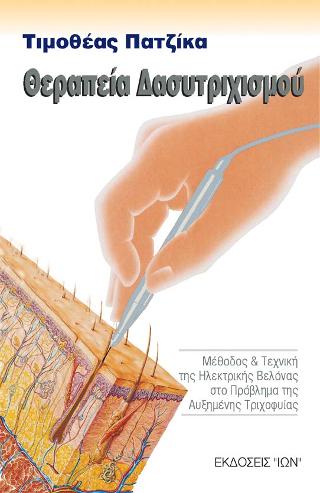 ΘΕΡΑΠΕΙΑ ΔΑΣΥΤΡΙΧΙΣΜΟΥ ΜΕΘΟΔΟΣ ΚΑΙ ΤΕΧΝΙΚΗ ΤΗΣ ΗΛΕΚΤΡΙΚΗΣ ΒΕΛΟΝΑΣ ΣΤΟ ΠΡΟΒΛΗΜΑ ΤΗΣ ΑΥΞΗΜΕΝΗΣ ΤΡΙΧΟΦΥΙΑΣ