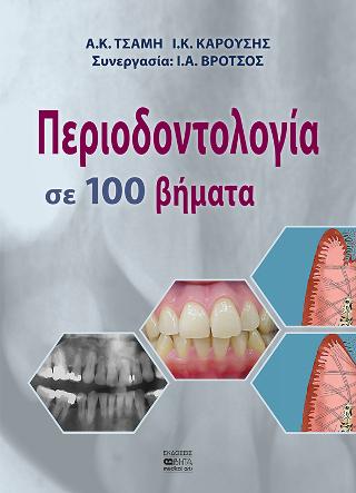 ΠΕΡΙΟΔΟΝΤΟΛΟΓΙΑ ΣΕ 100 ΒΗΜΑΤΑ